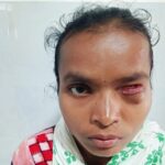 ଗୋଟିଏ ଆଖି ନଥାଇବି ମିଳୁନାହିଁ ଭତ୍ତା